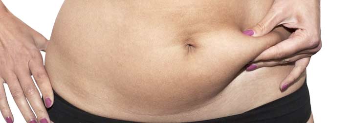 abdominoplastie Tunisie