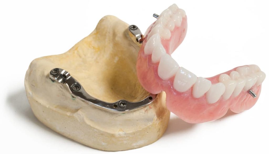 Prothesiste dentaire en tunisie image