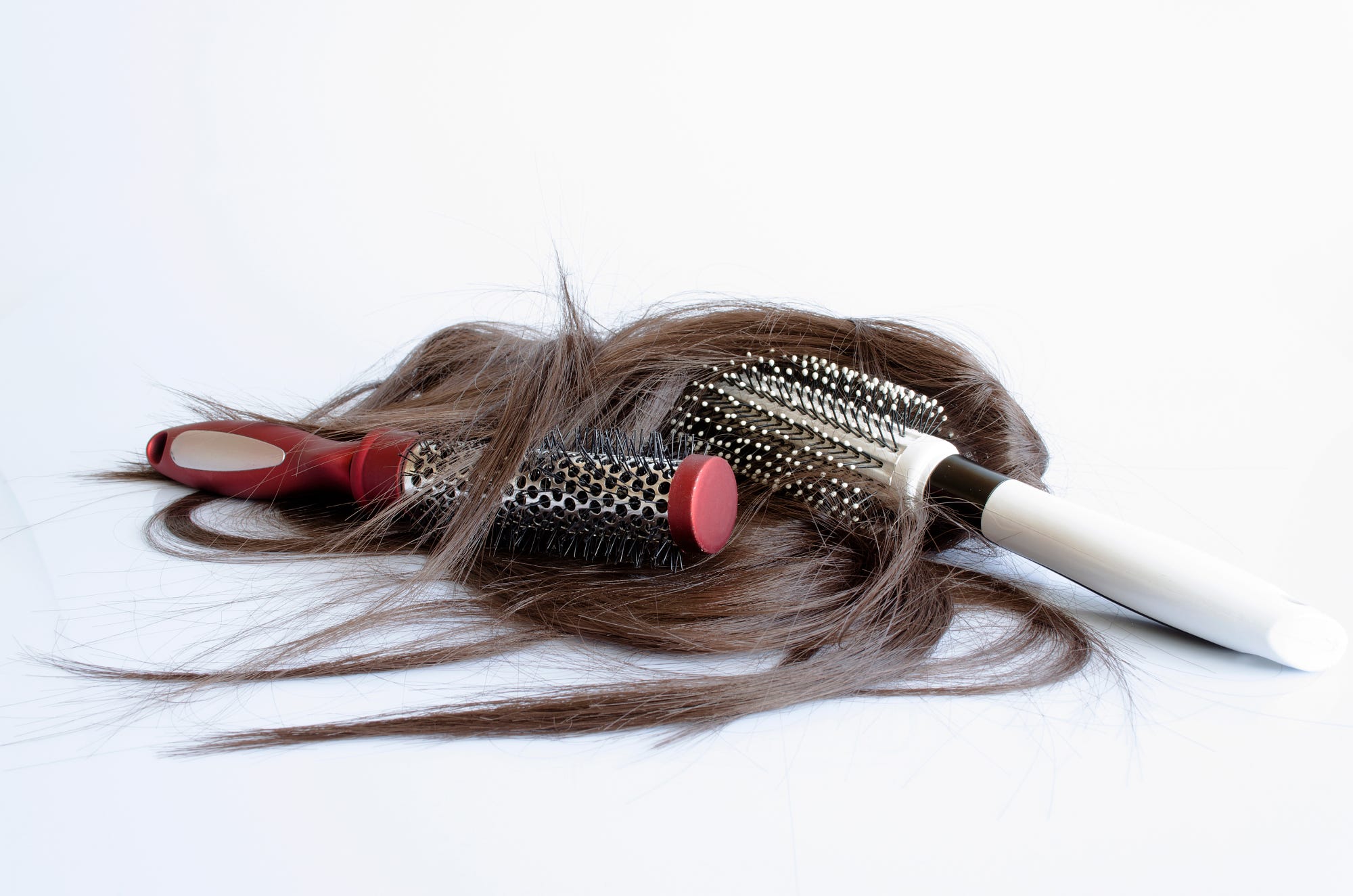 Perte de cheveux chez la femme