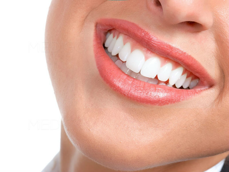 dents blanches