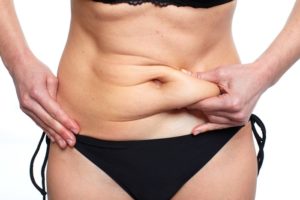 abdominoplastie en Tunisie