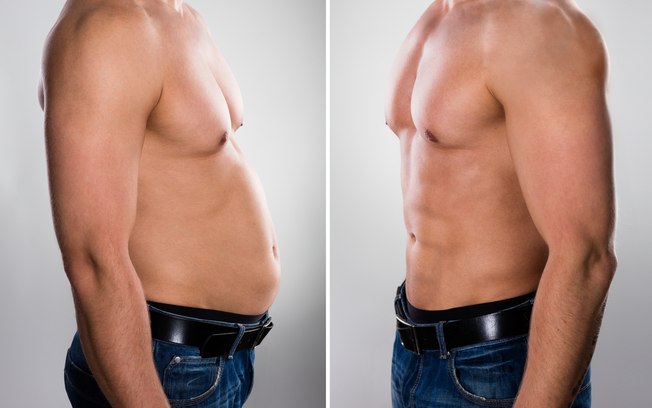 liposuccion au laser Tunisie