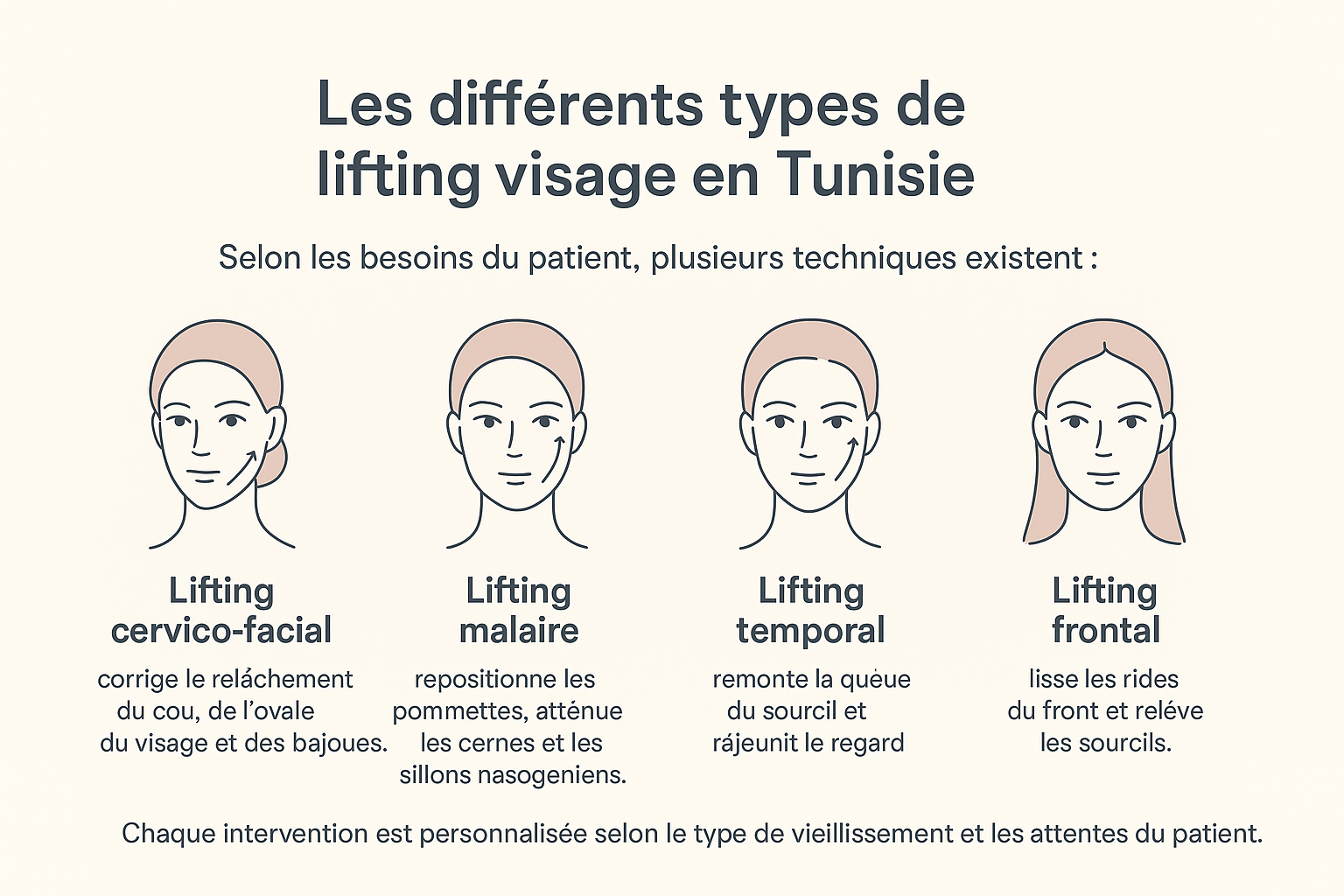 Les différents types du lifting visage [Infographie]