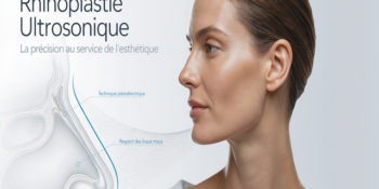 La rhinoplastie ultrasonique