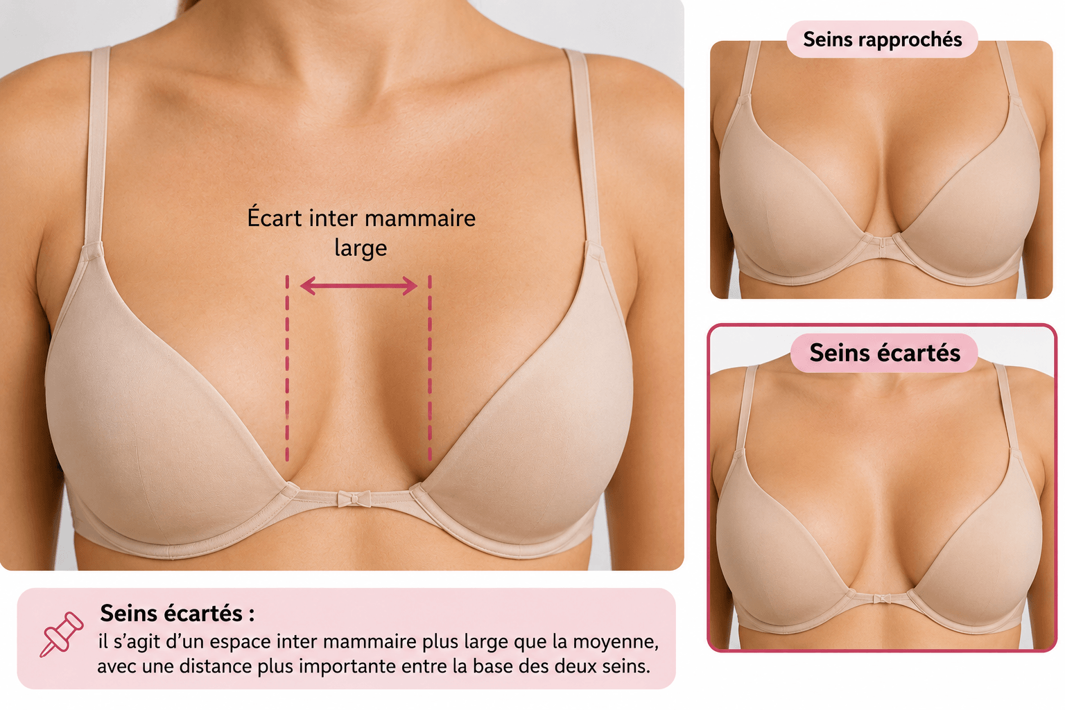 seins écartés : causes et solutions